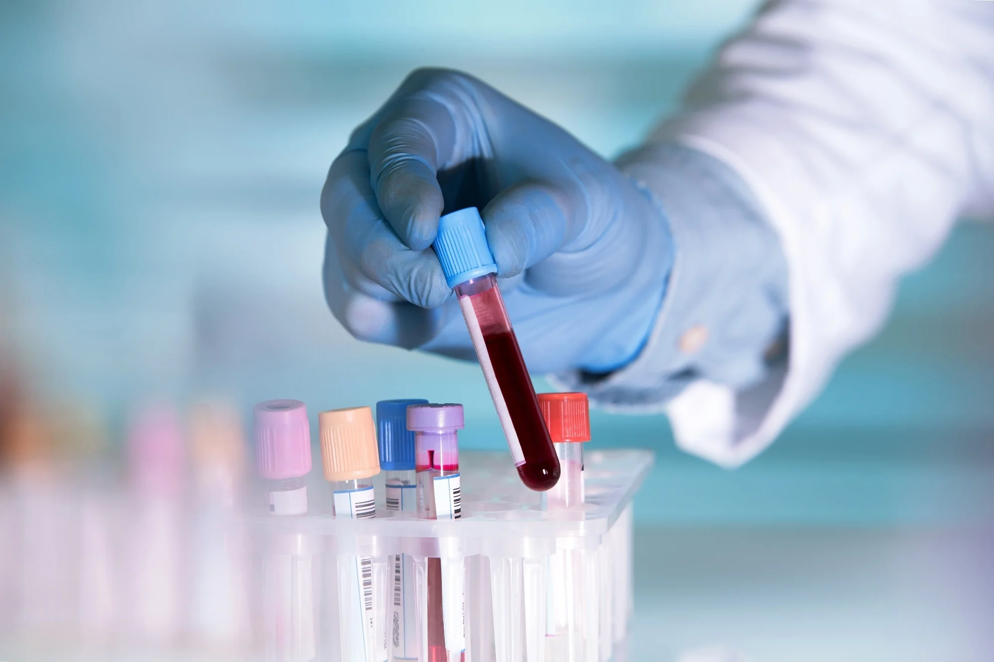 Medical Laboratory Testing for Cancer: Early Detection and Monitoring